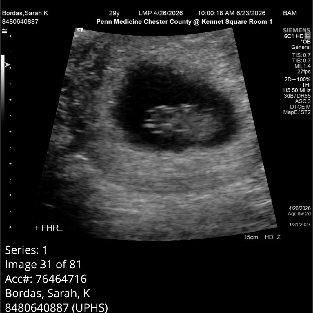 Photo shared by Sarah for their Babylist baby registry.