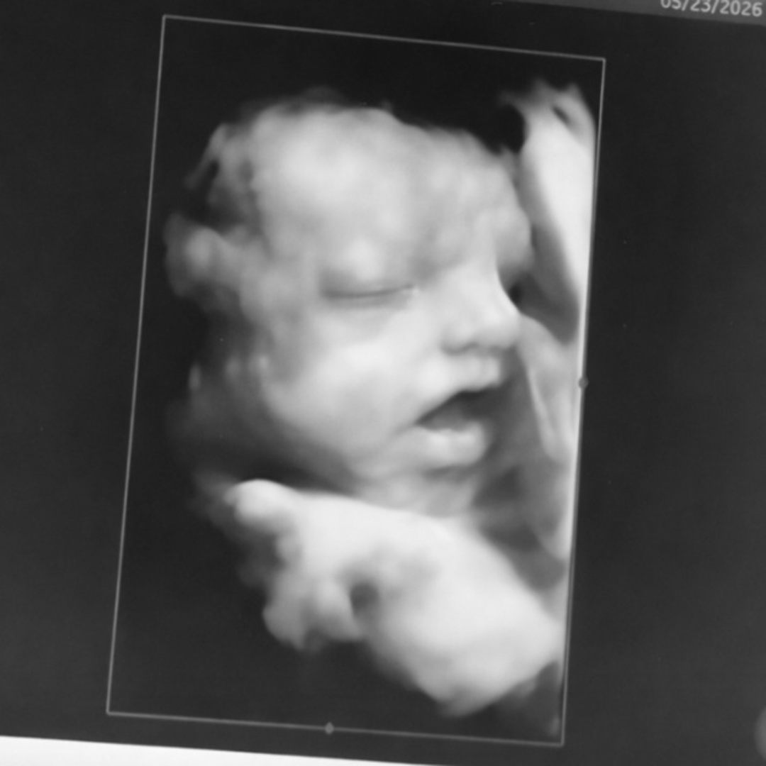 Photo shared by Devin for their Babylist baby registry.