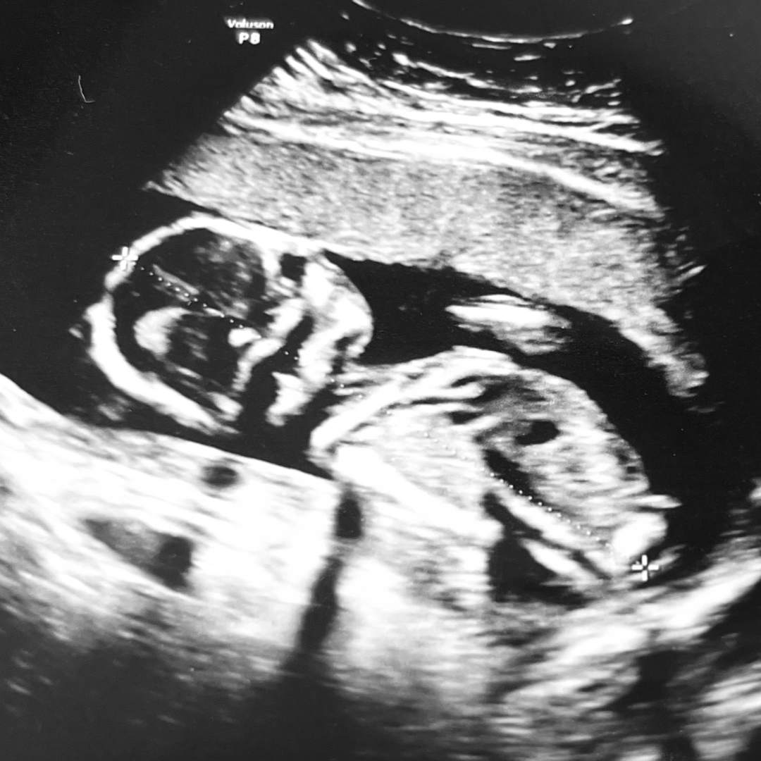 Photo shared by Jaci for their Babylist baby registry.
