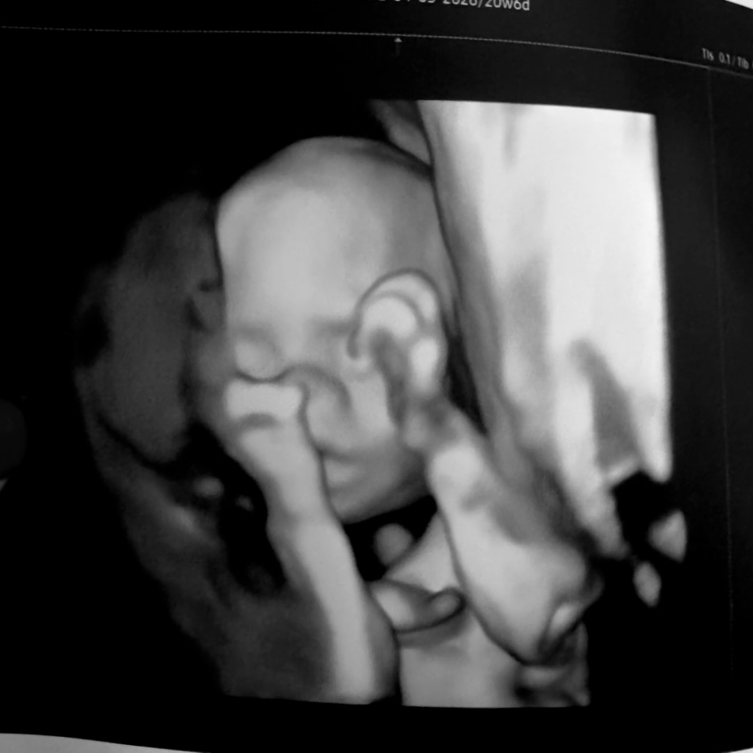 Photo shared by Cheyanne for their Babylist baby registry.