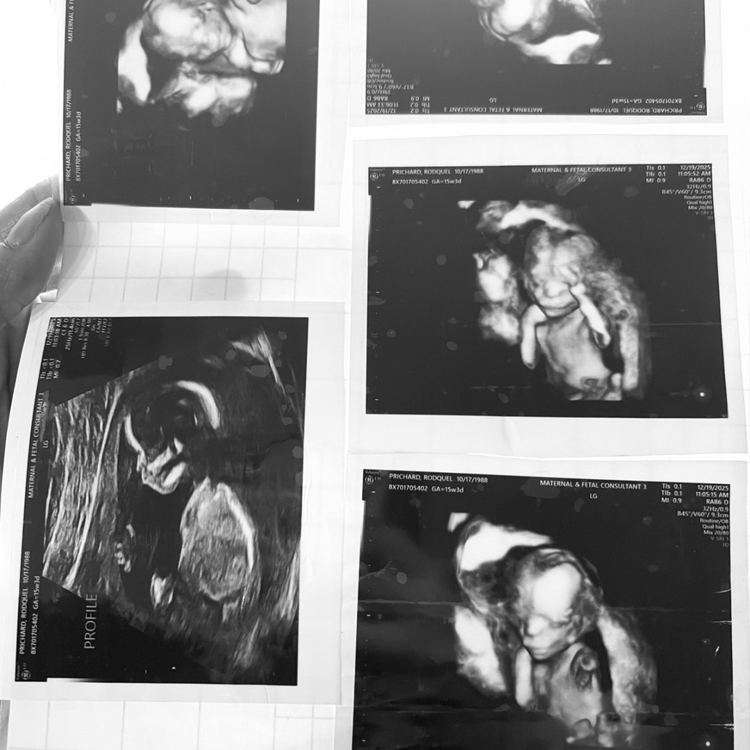 Photo shared by Rocky for their Babylist baby registry.