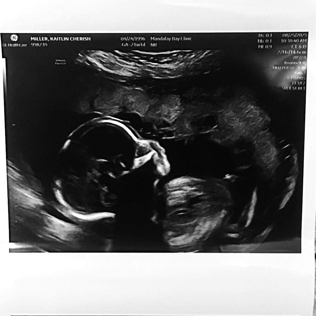 Photo shared by Kaiti for their Babylist baby registry.