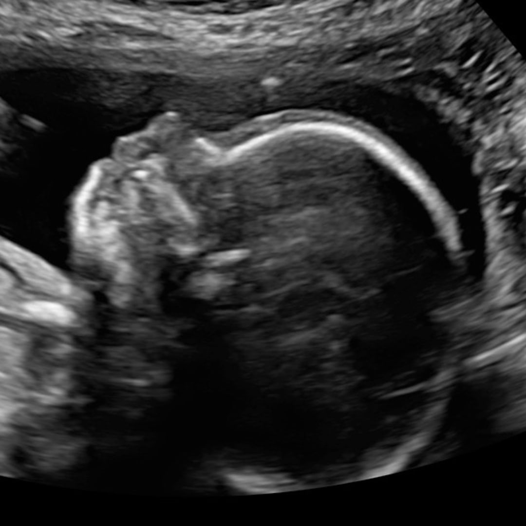 Photo shared by Mama for their Babylist baby registry.