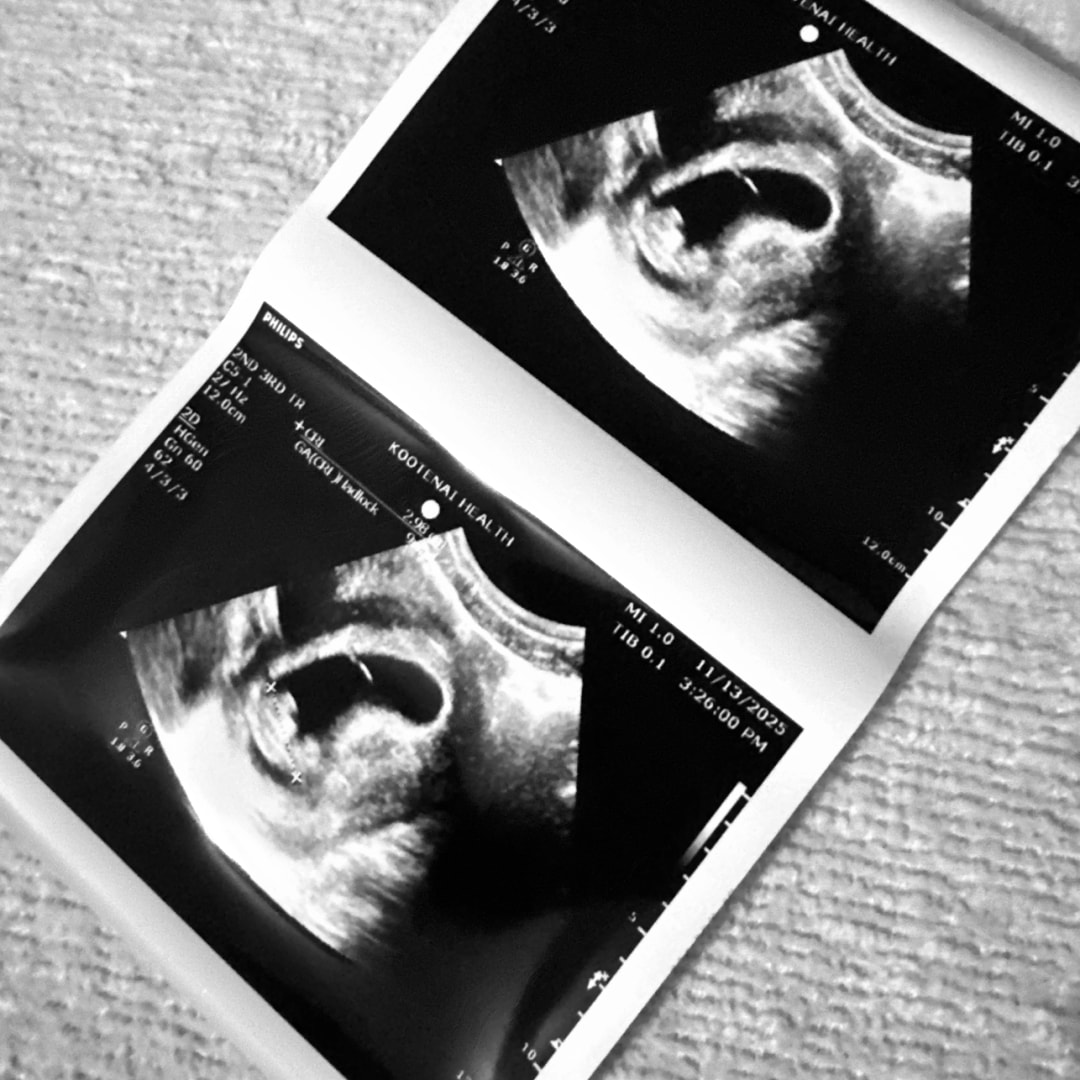 Photo shared by Tiffany for their Babylist baby registry.