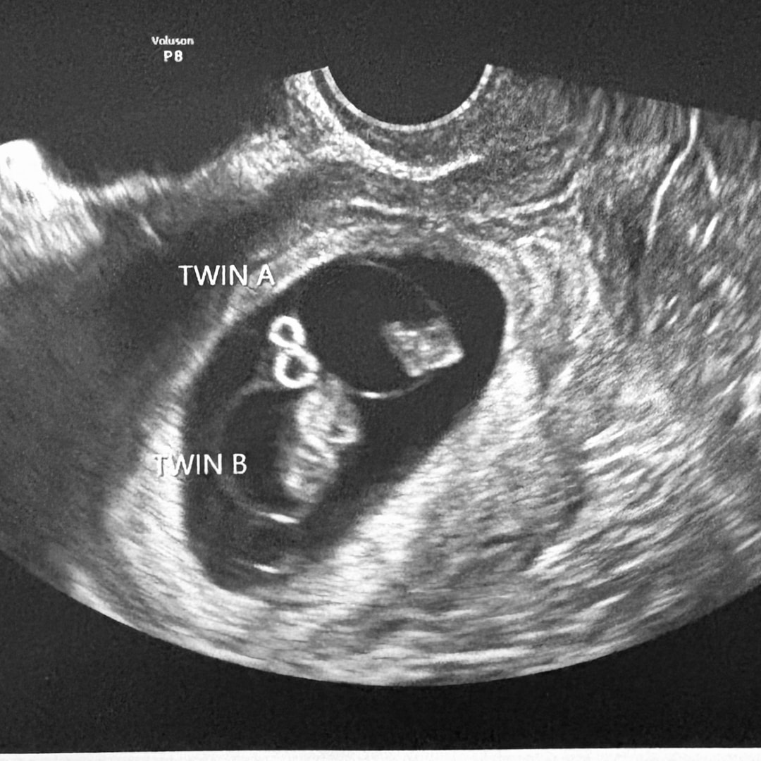 Photo shared by Bano for their Babylist baby registry.