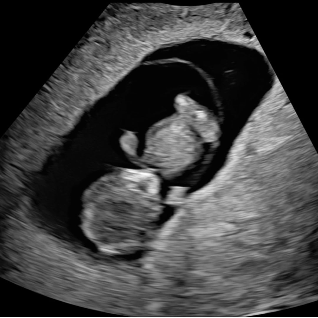 Photo shared by Katelyn for their Babylist baby registry.