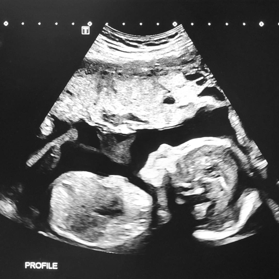 Photo shared by Jenna for their Babylist baby registry.