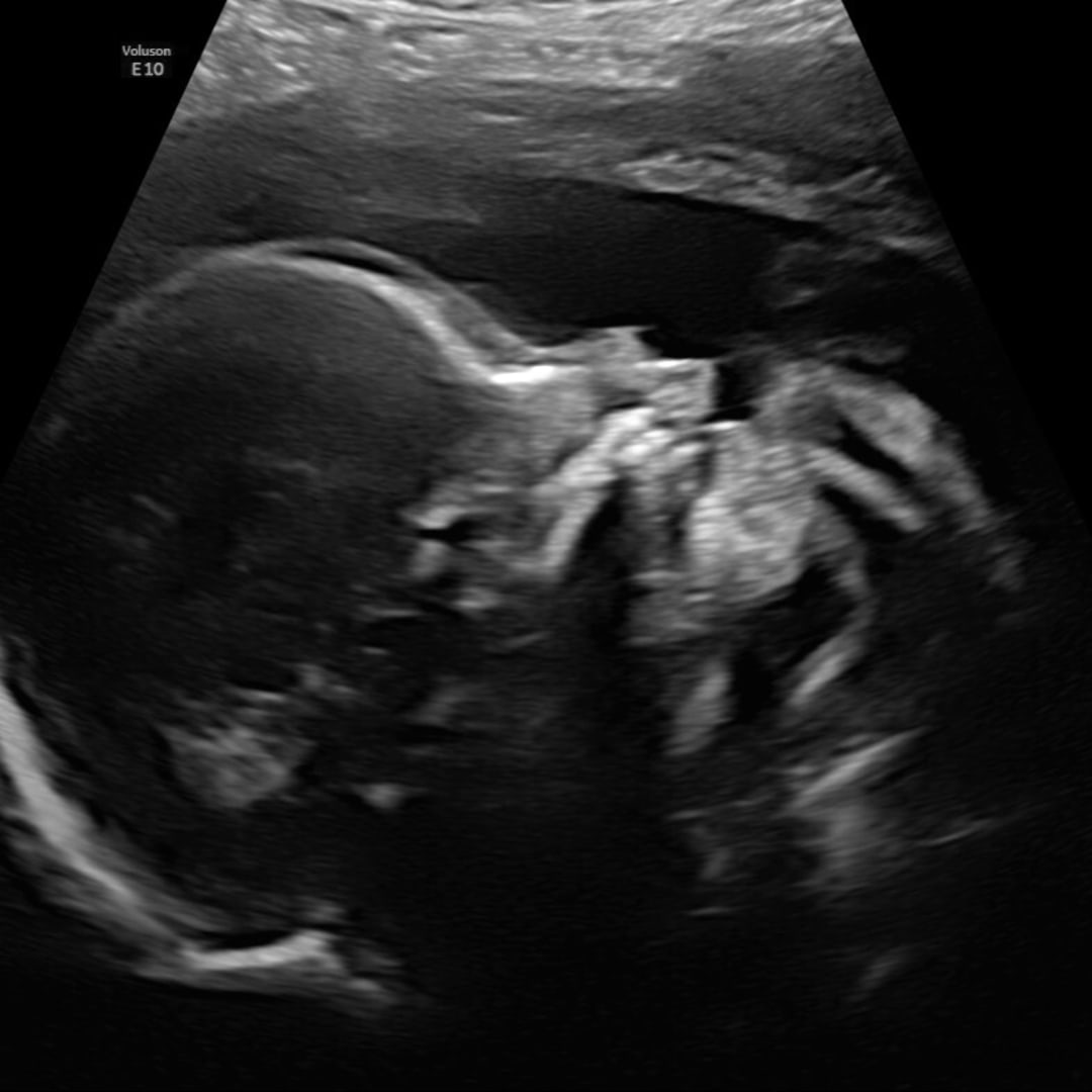 Photo shared by Emily for their Babylist baby registry.