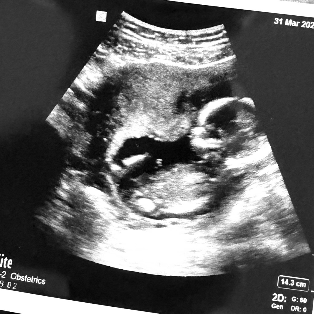 Photo shared by Lauren for their Babylist baby registry.