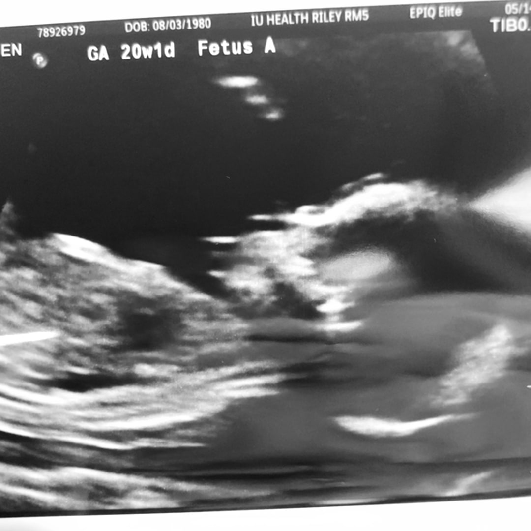 Photo shared by Autumn for their Babylist baby registry.