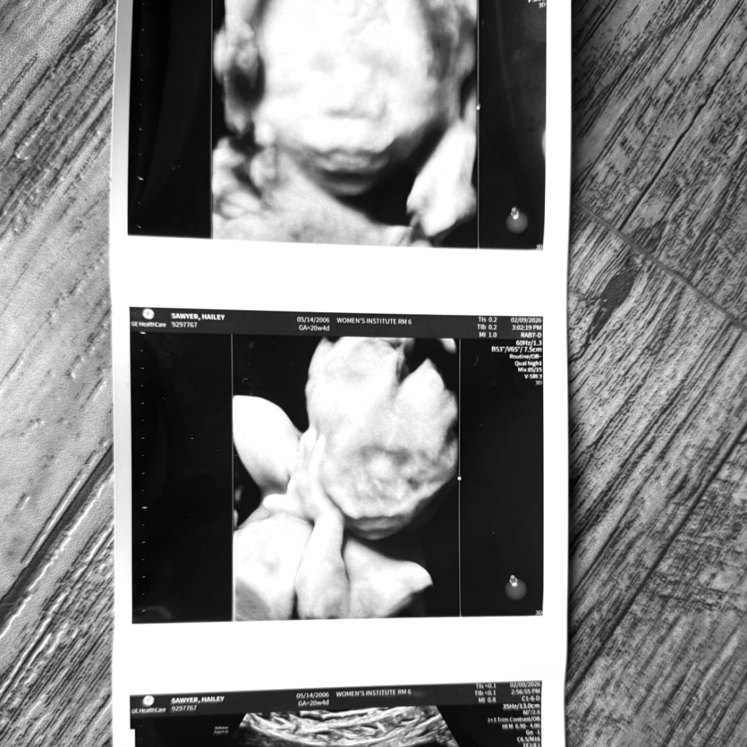 Photo shared by Hailey for their Babylist baby registry.