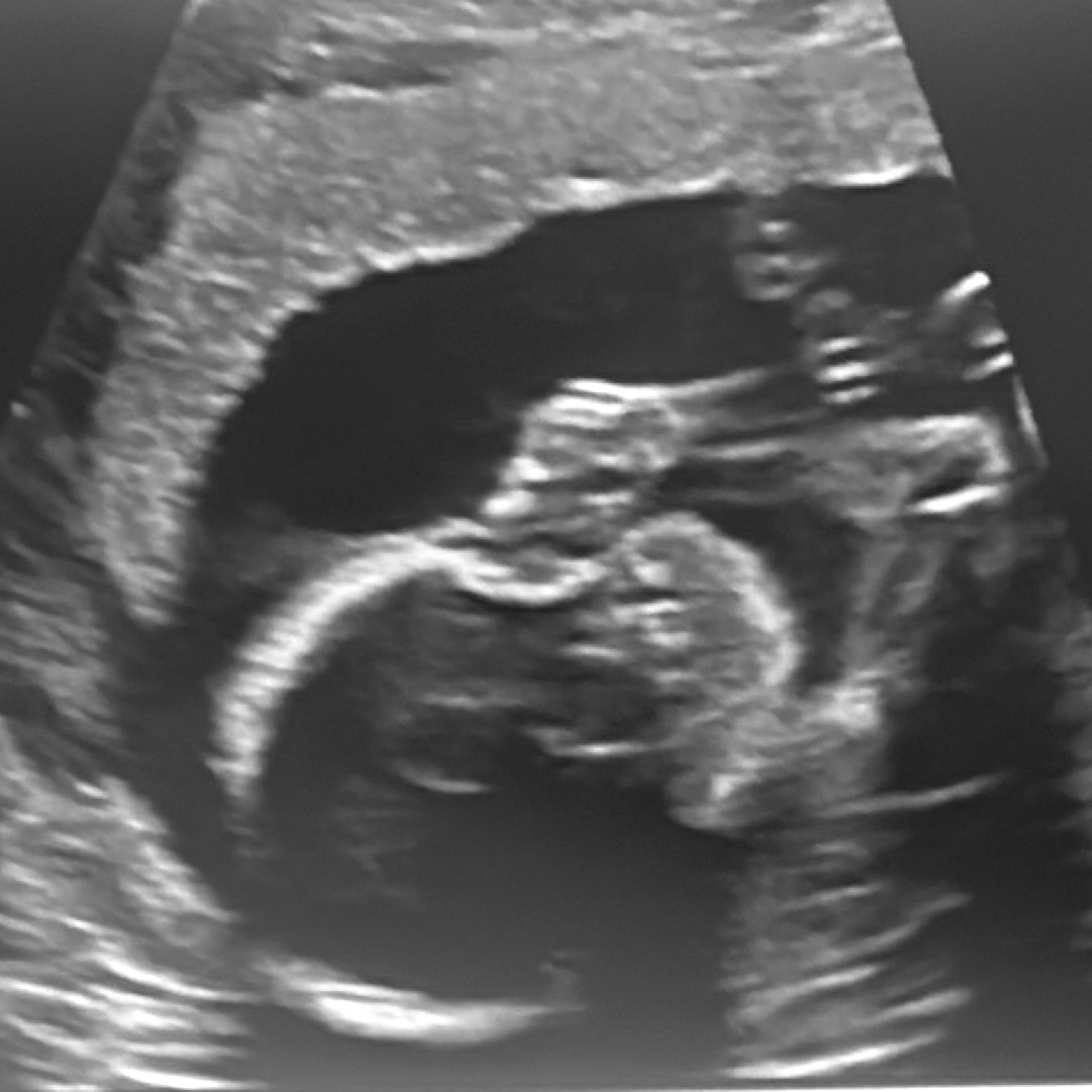 Photo shared by Mariana for their Babylist baby registry.