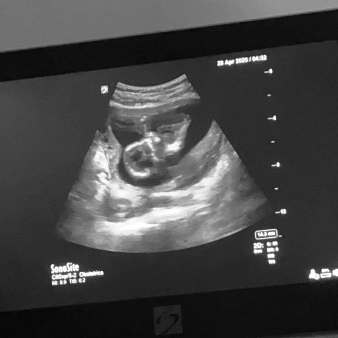 Photo shared by Chyanne for their Babylist baby registry.