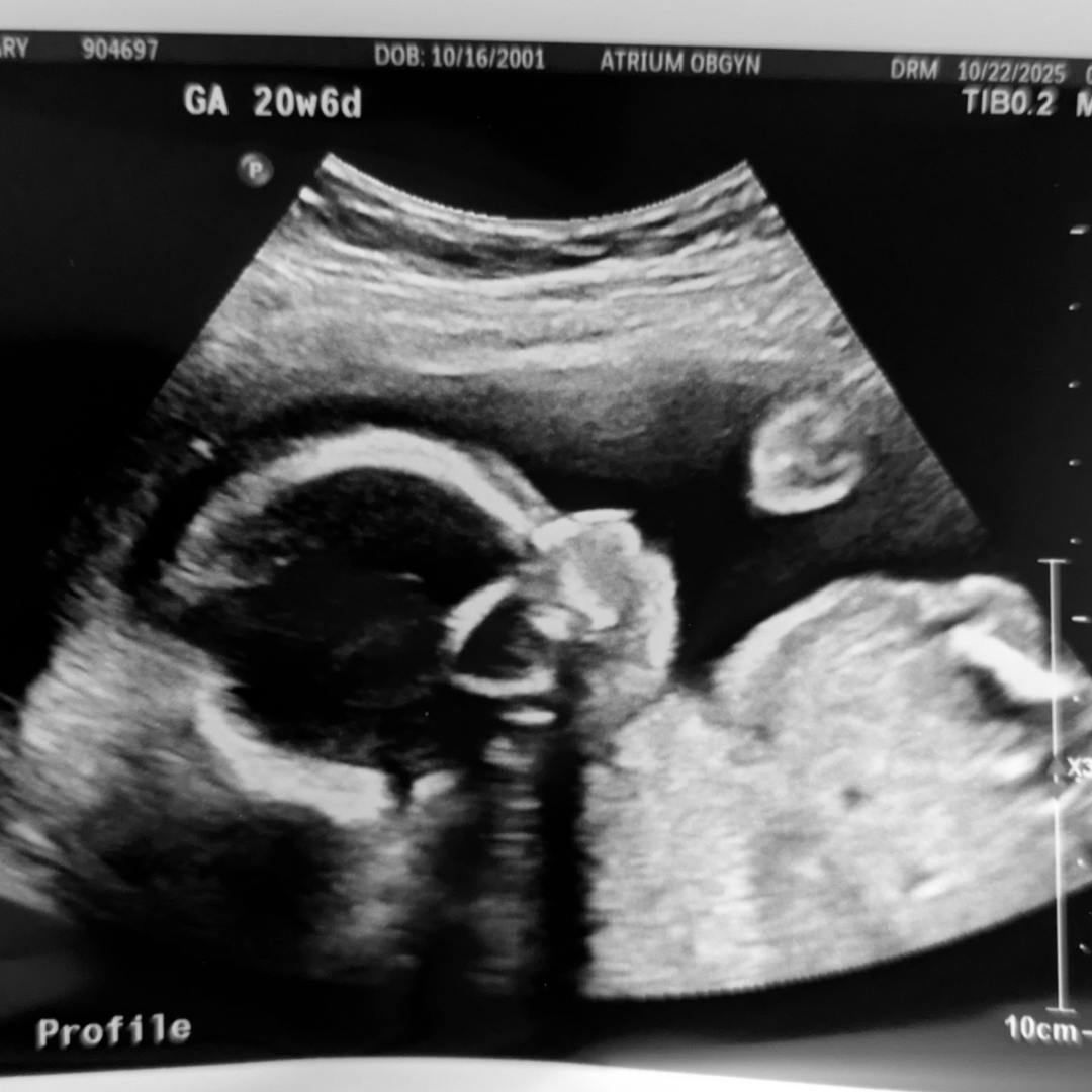 Photo shared by Lizzy for their Babylist baby registry.