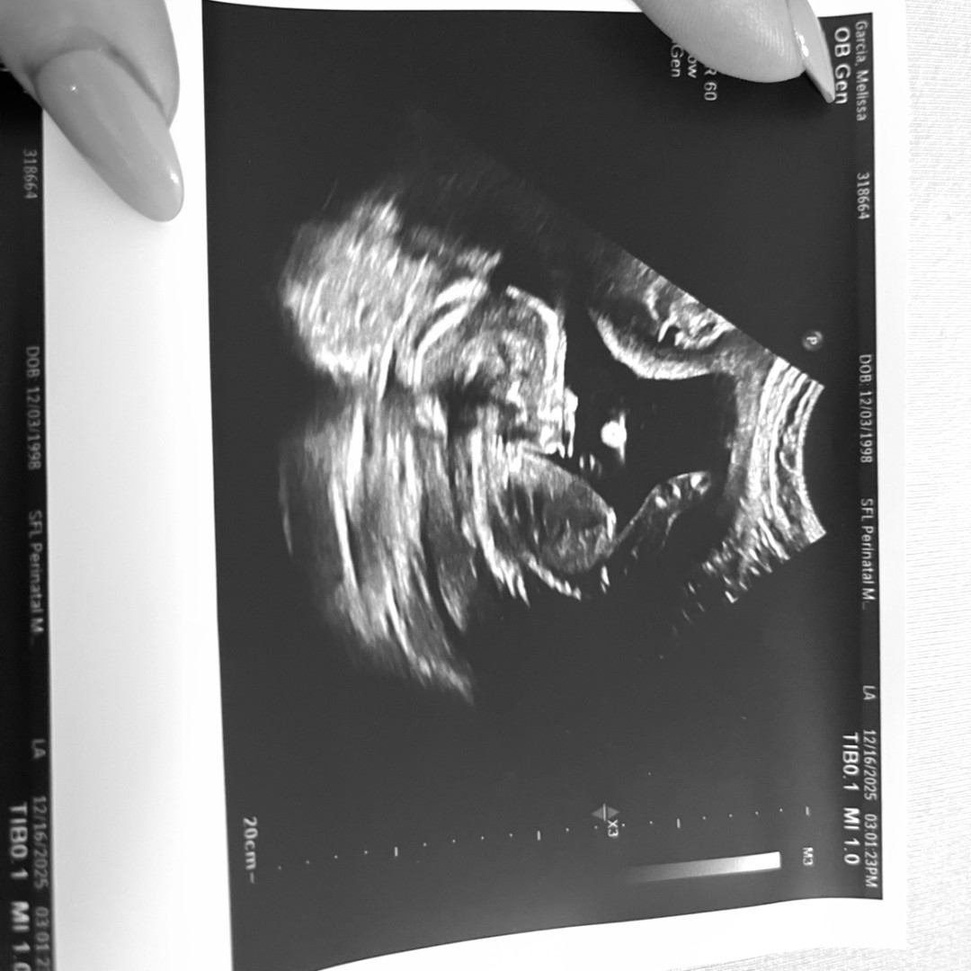 Photo shared by Melissa for their Babylist baby registry.