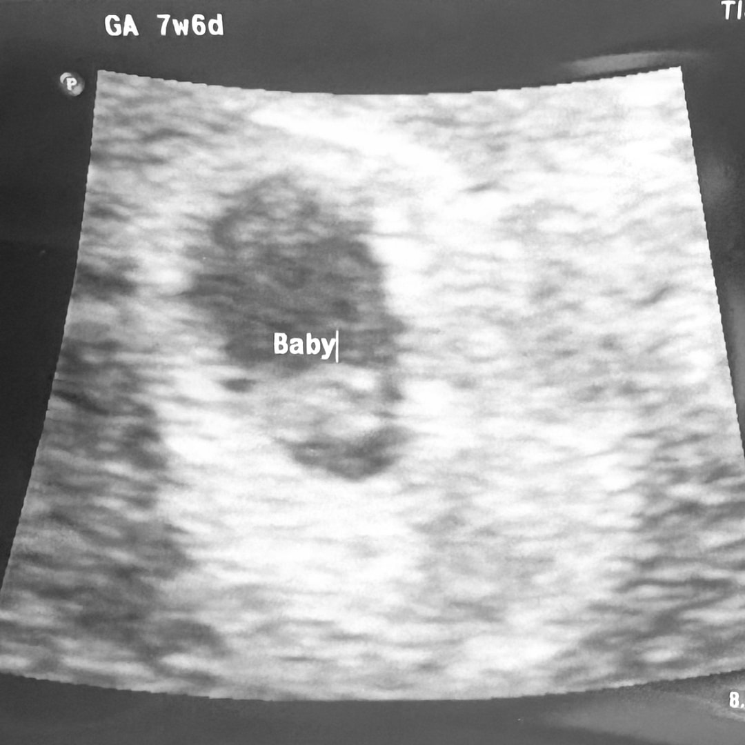 Photo shared by Gabrielle for their Babylist baby registry.