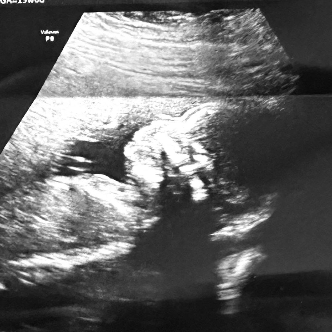 Photo shared by Jaiden for their Babylist baby registry.