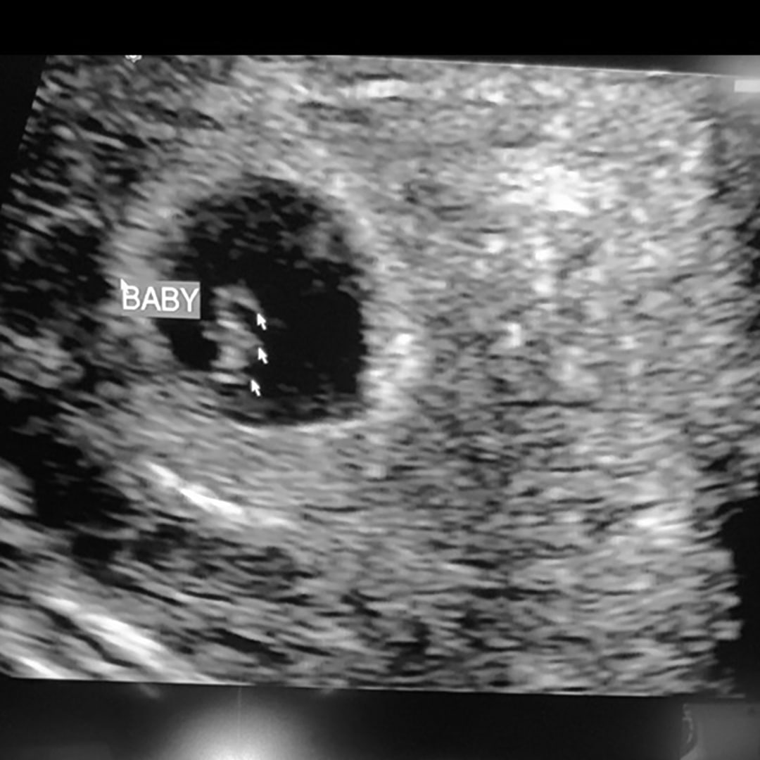 Photo shared by Sonia for their Babylist baby registry.