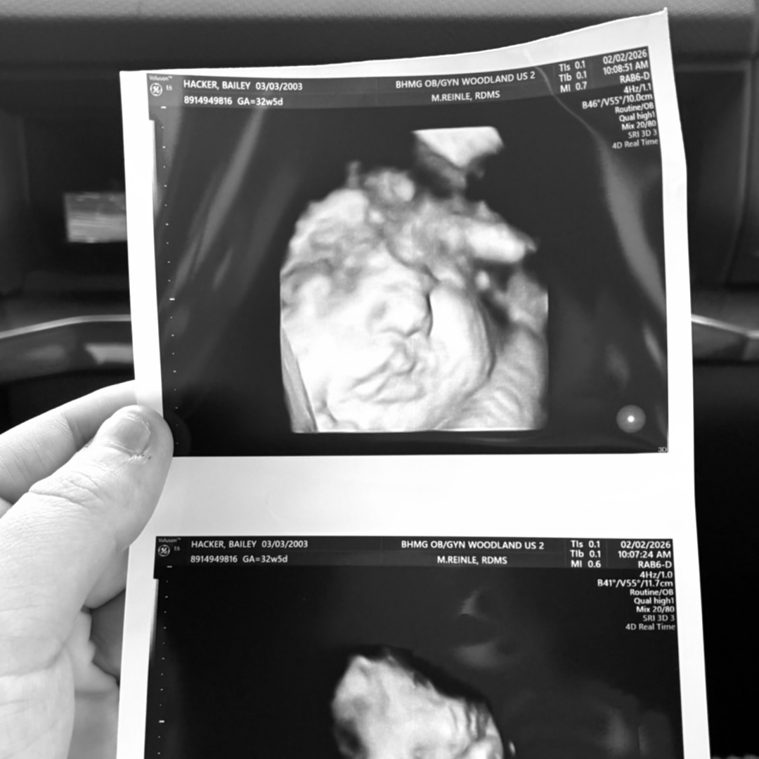 Photo shared by Bailey for their Babylist baby registry.