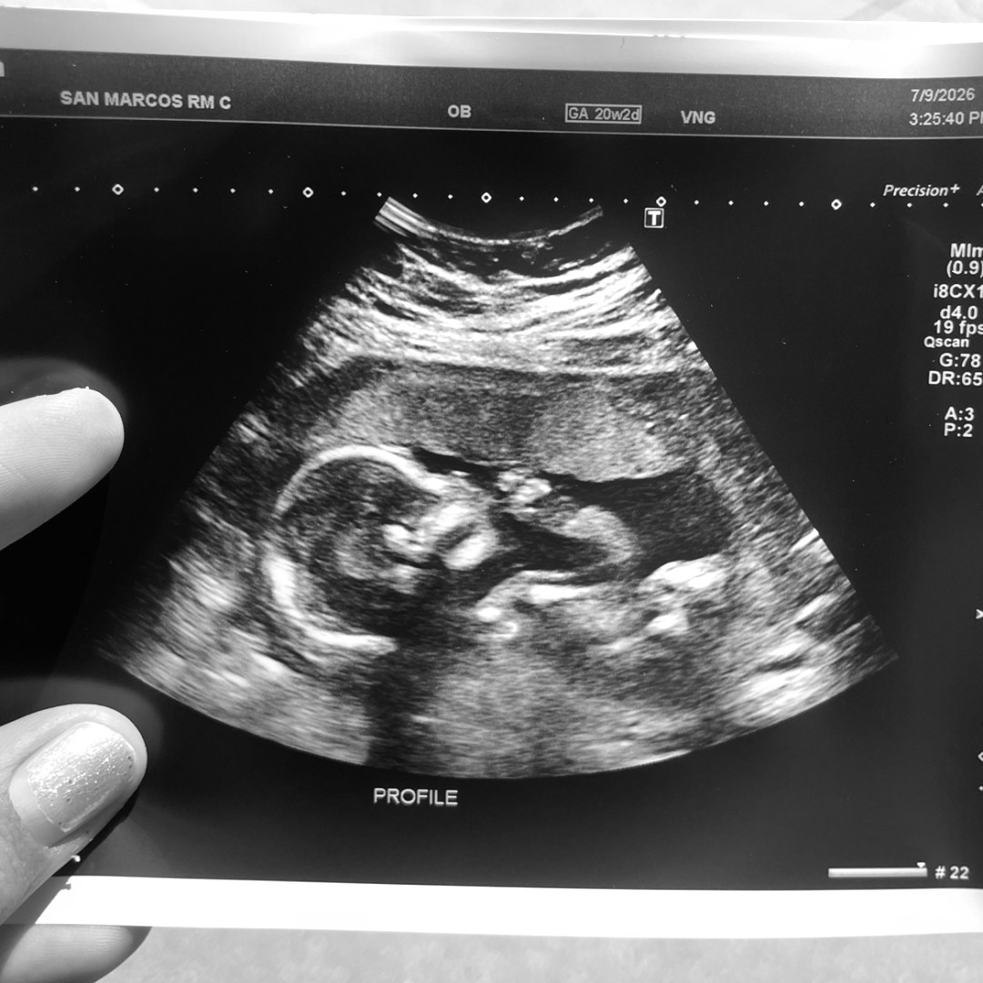 Photo shared by Amanda for their Babylist baby registry.