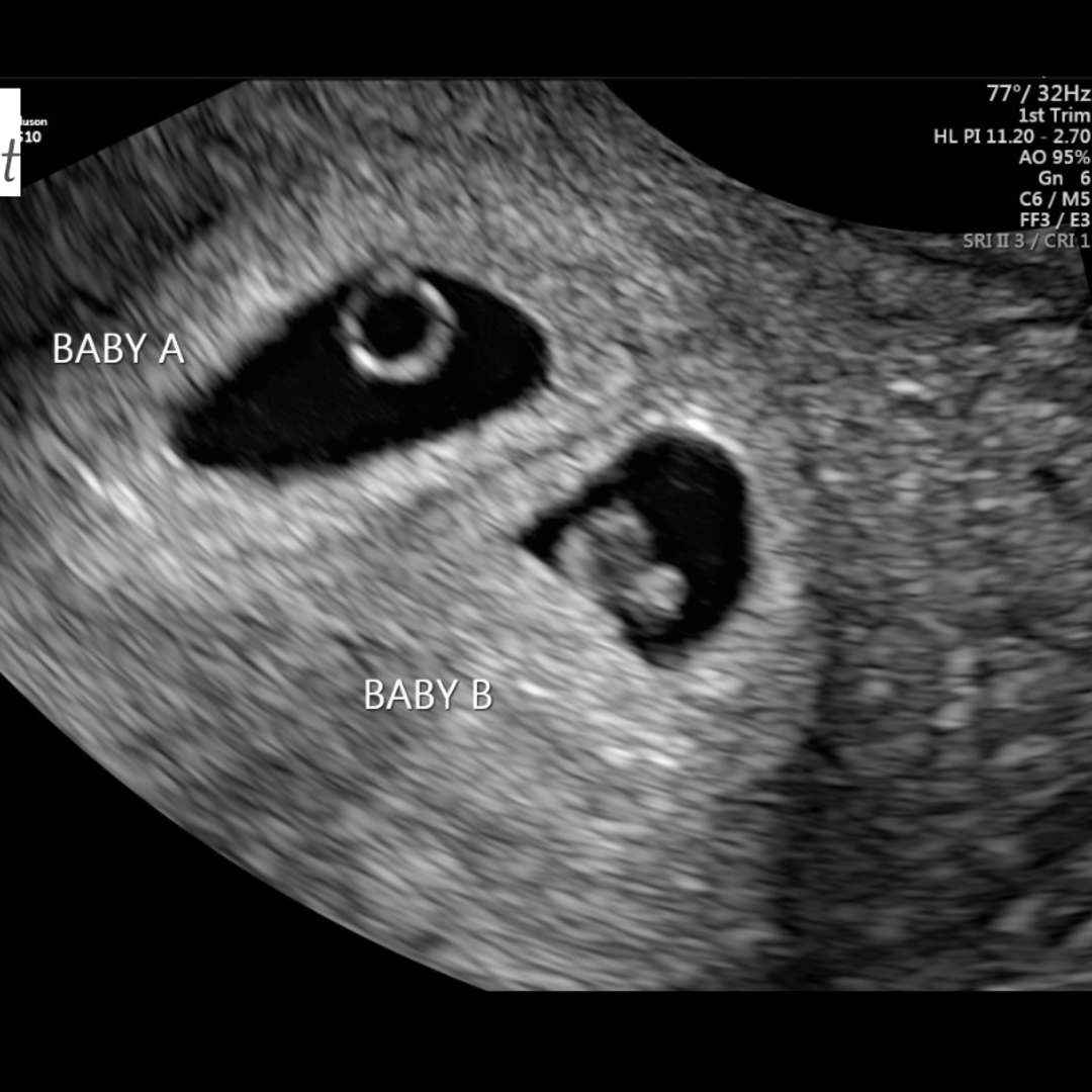 Photo shared by Keely for their Babylist baby registry.