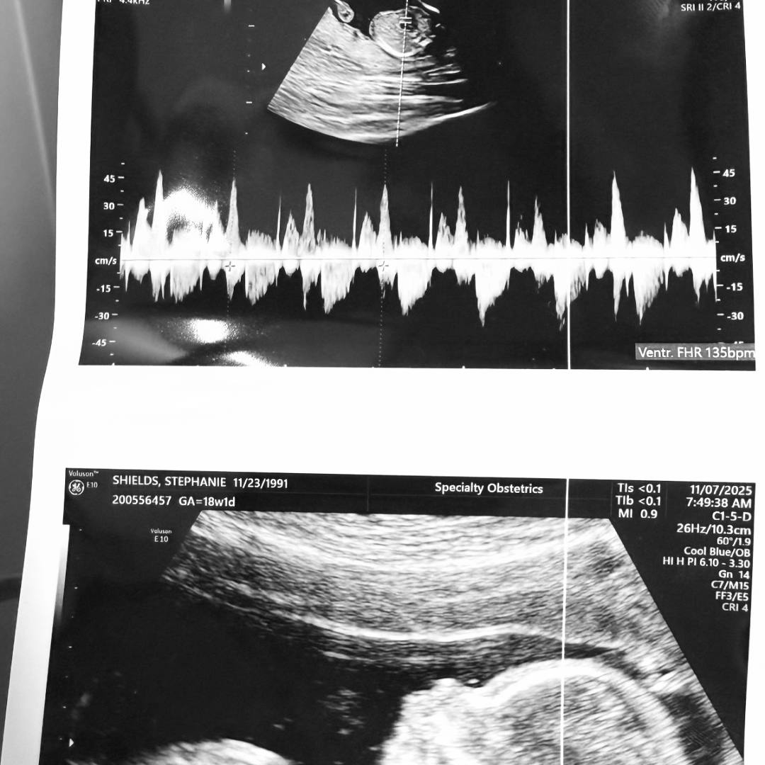 Photo shared by Richard for their Babylist baby registry.