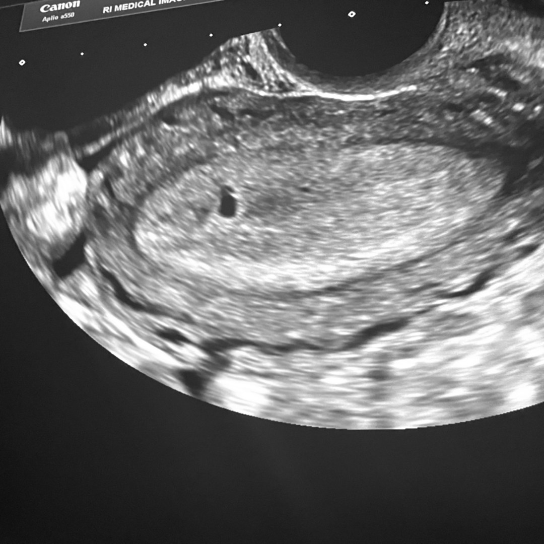Photo shared by Honesty for their Babylist baby registry.