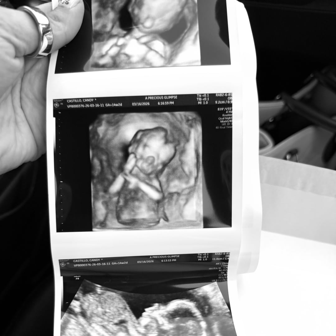 Photo shared by Candy for their Babylist baby registry.