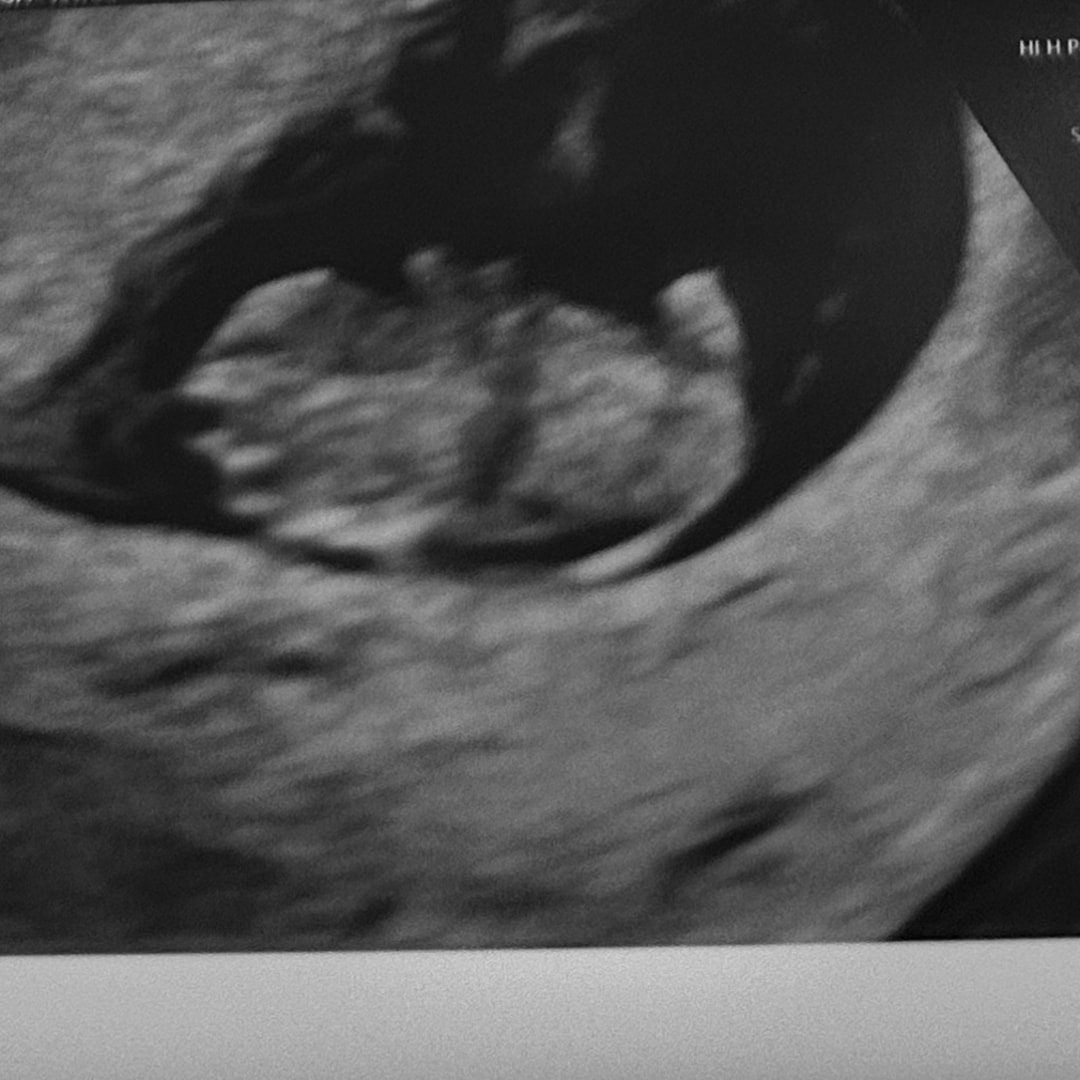 Photo shared by Hayley for their Babylist baby registry.