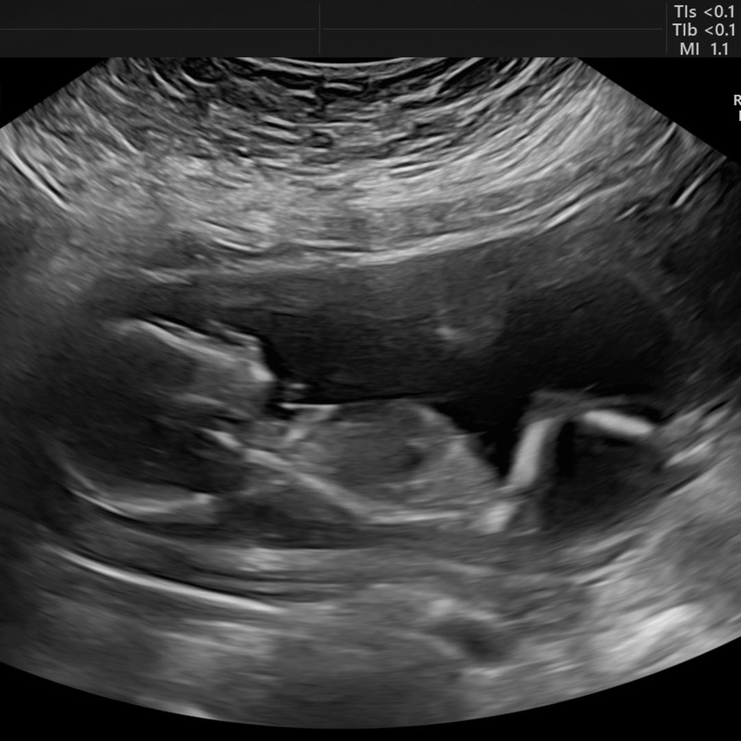 Photo shared by Kristina for their Babylist baby registry.