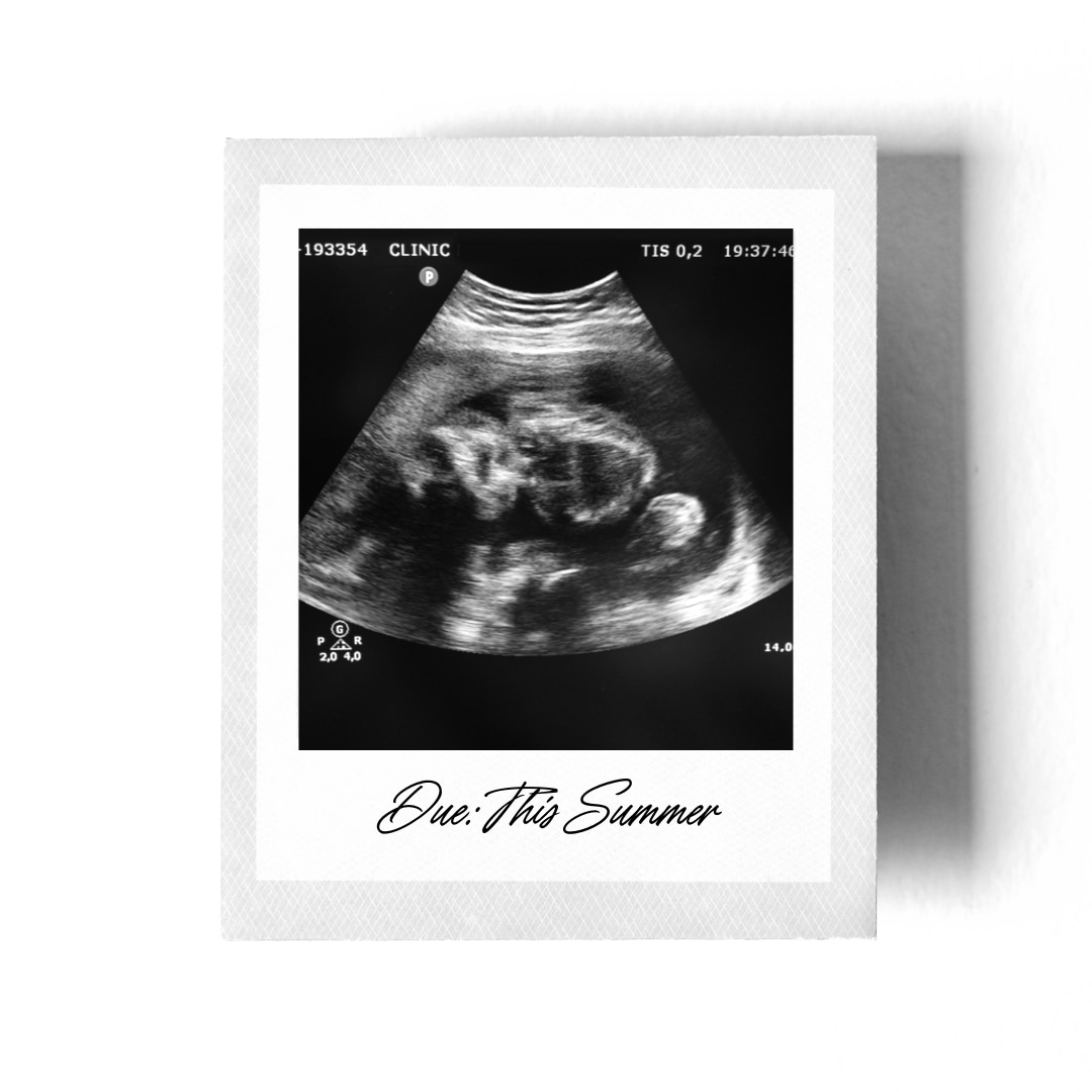 Photo shared by Peyton for their Babylist baby registry.