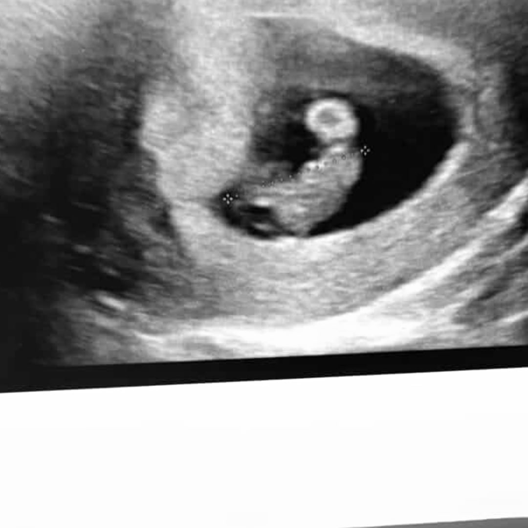 Photo shared by Teresa for their Babylist baby registry.