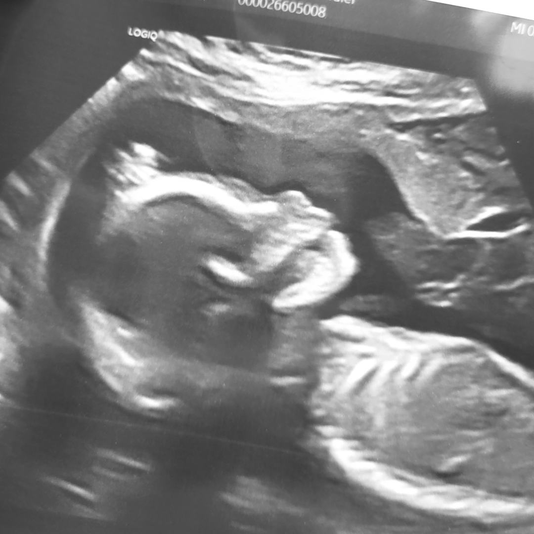 Photo shared by Chandler for their Babylist baby registry.