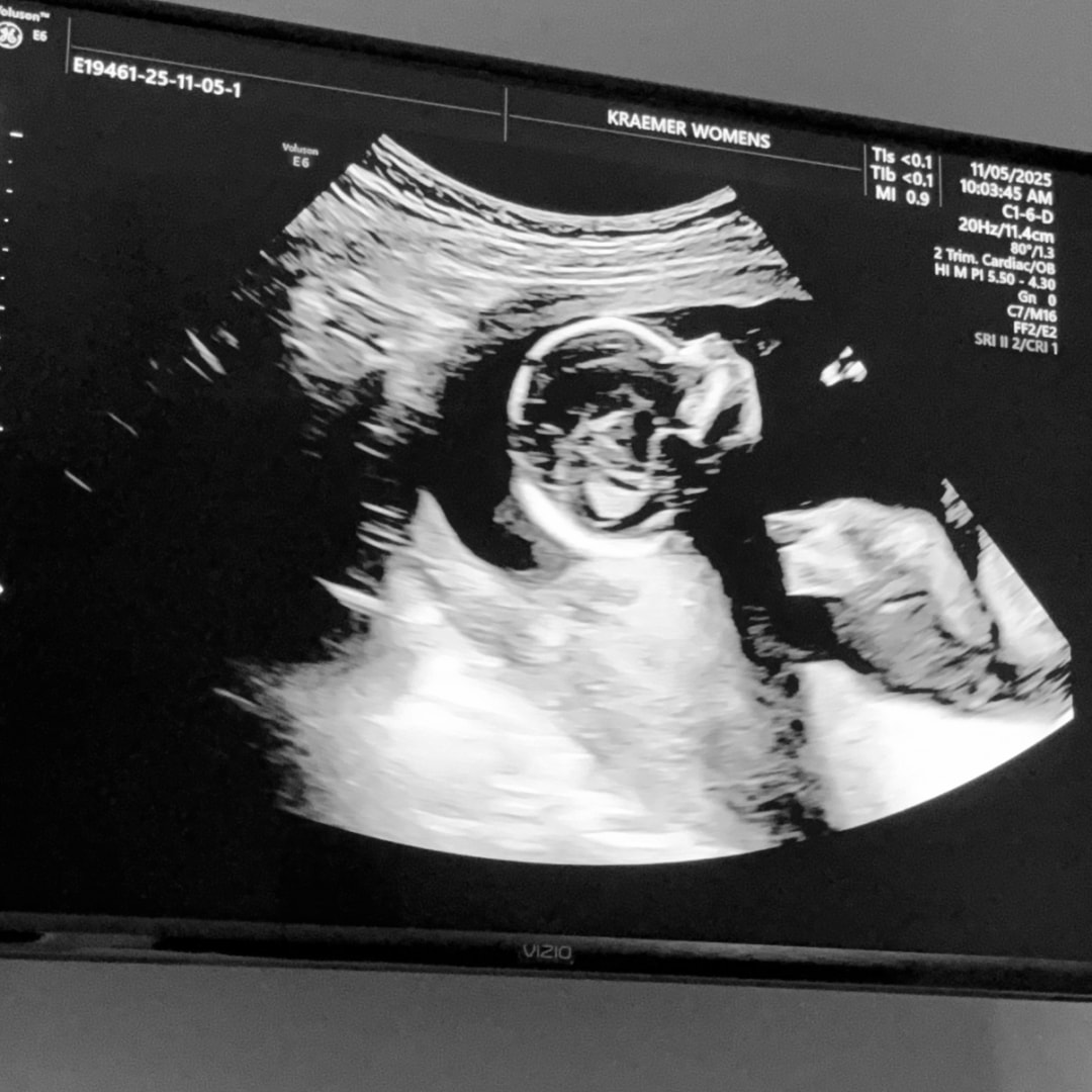 Photo shared by Tiffany for their Babylist baby registry.