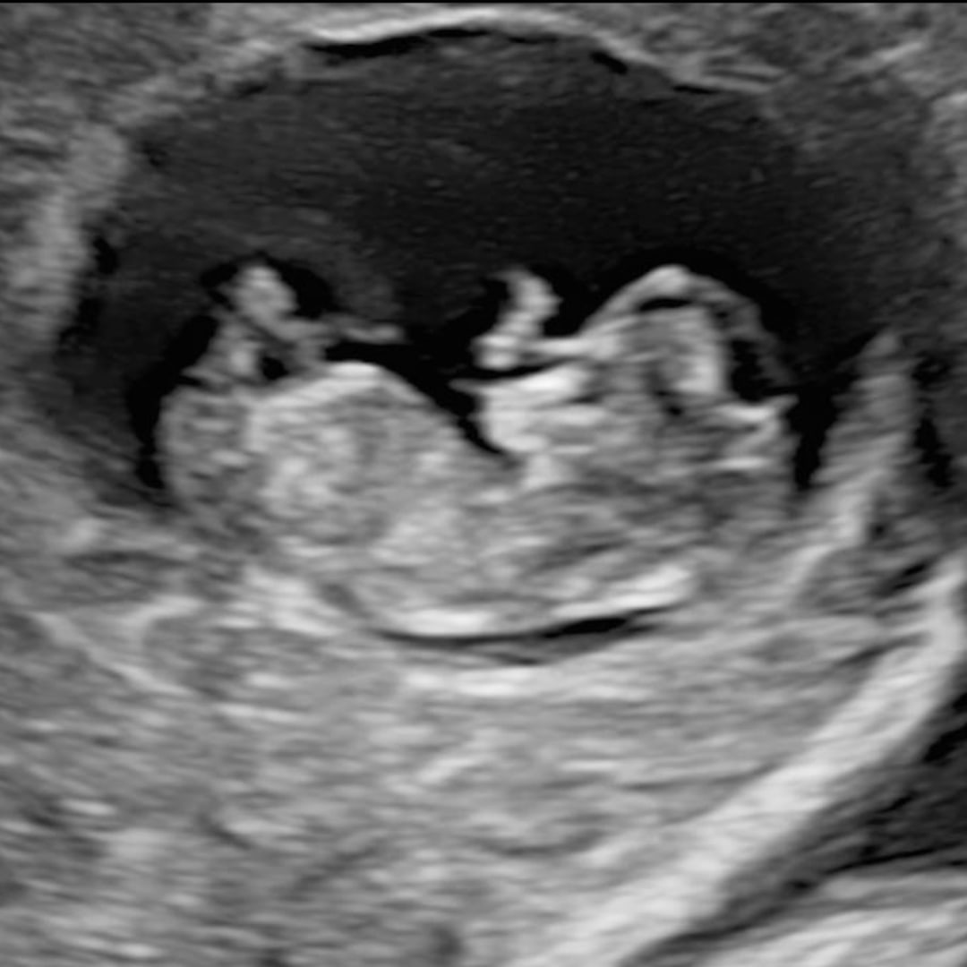 Photo shared by Ashley for their Babylist baby registry.