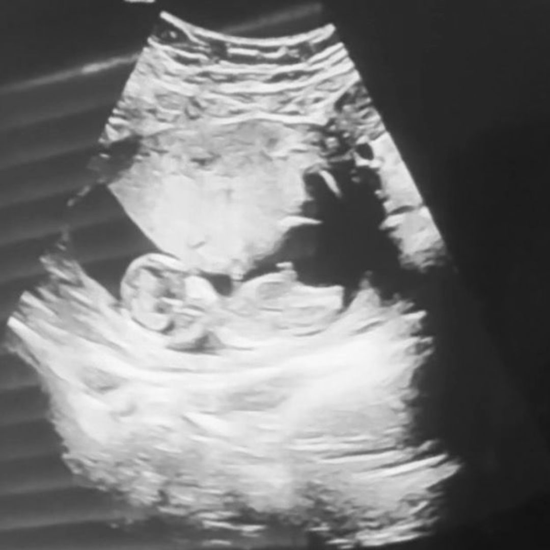 Photo shared by Lexi for their Babylist baby registry.