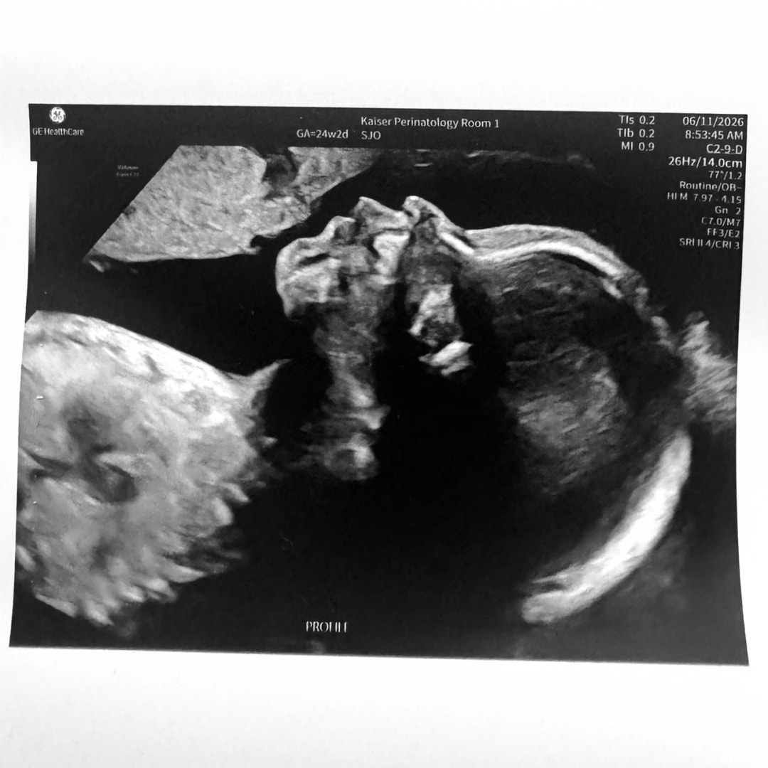 Photo shared by Christie for their Babylist baby registry.