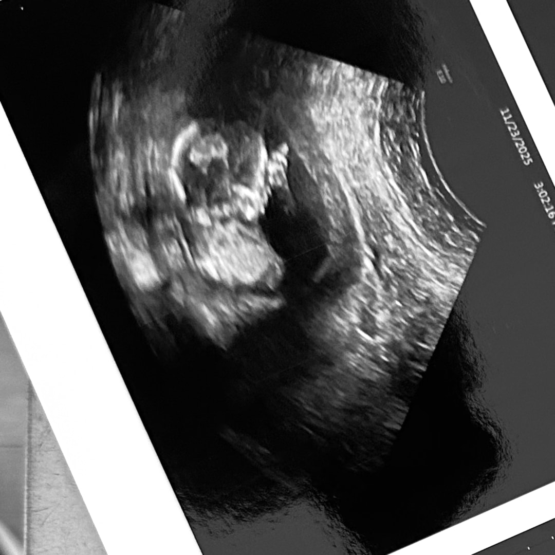 Photo shared by Joseline for their Babylist baby registry.