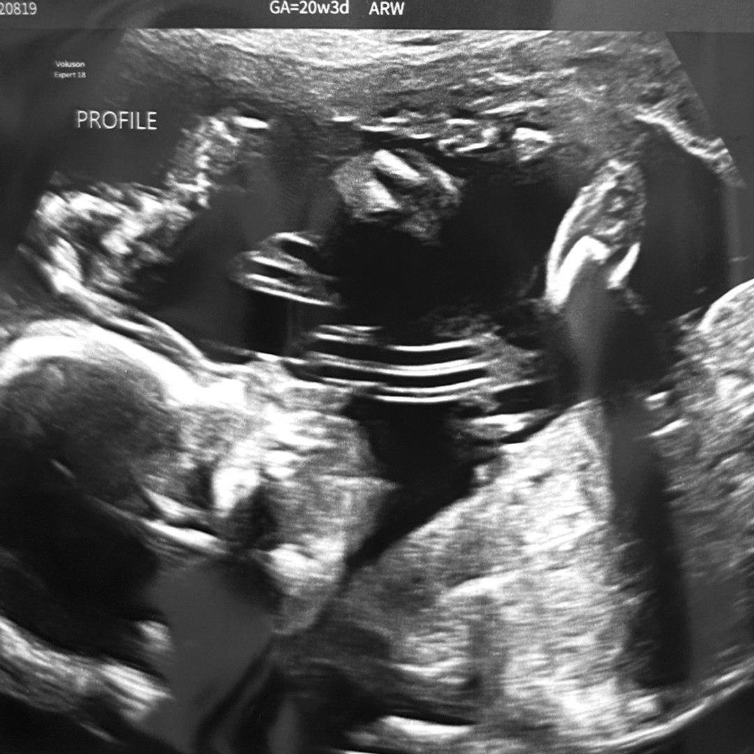 Photo shared by Isabella for their Babylist baby registry.