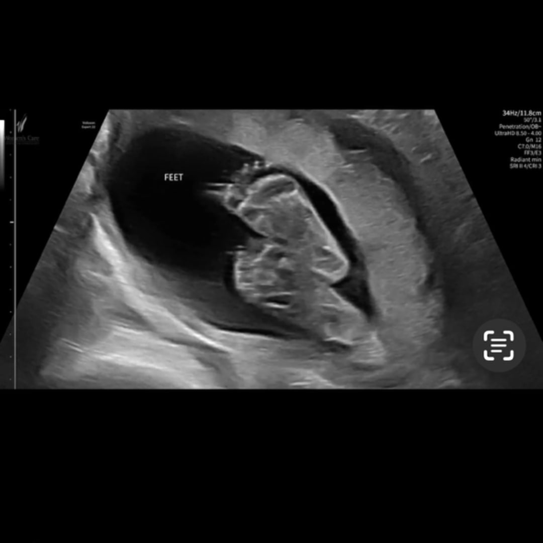 Photo shared by Peyton for their Babylist baby registry.