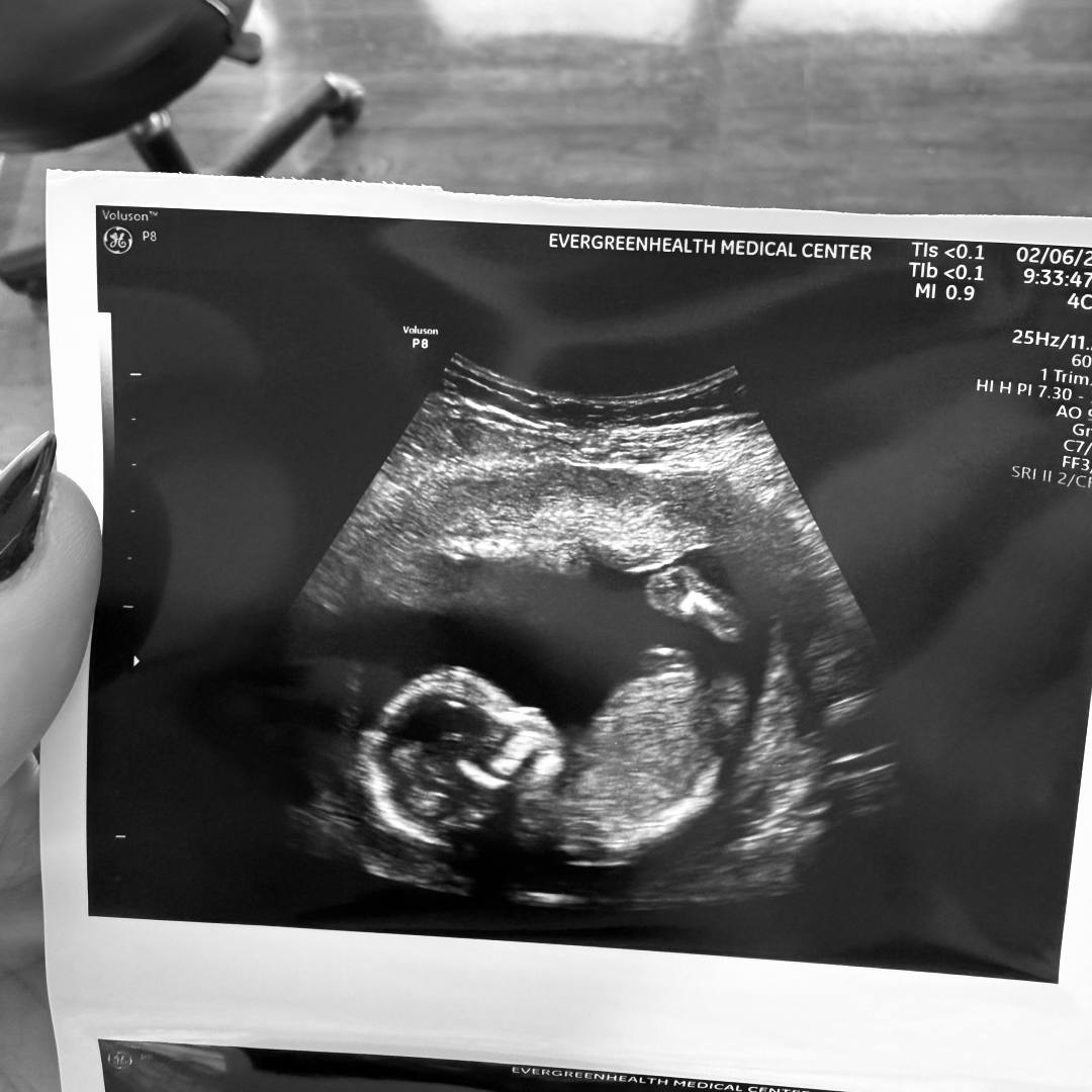 Photo shared by Laci for their Babylist baby registry.