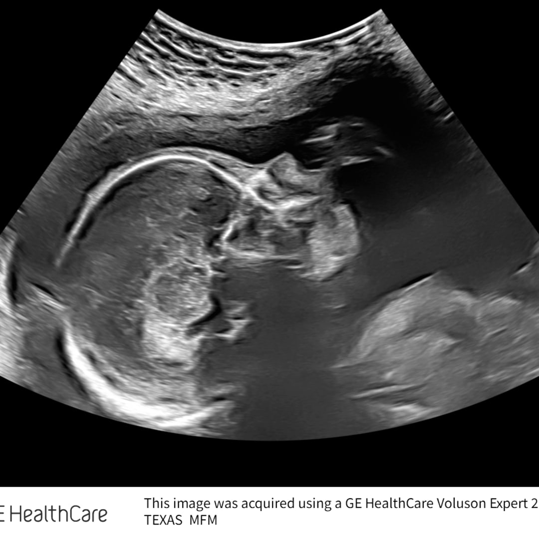 Photo shared by Bella for their Babylist baby registry.