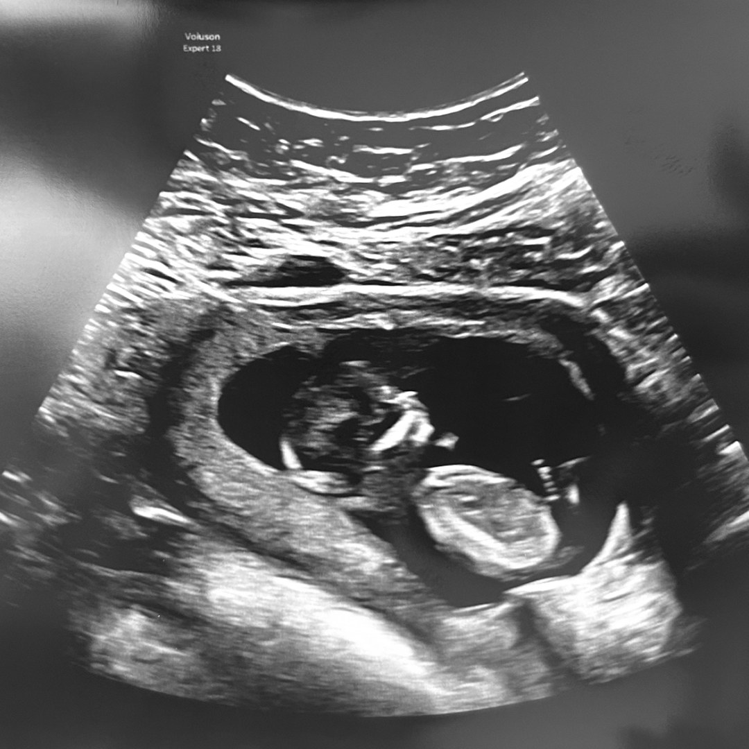 Photo shared by Emma for their Babylist baby registry.