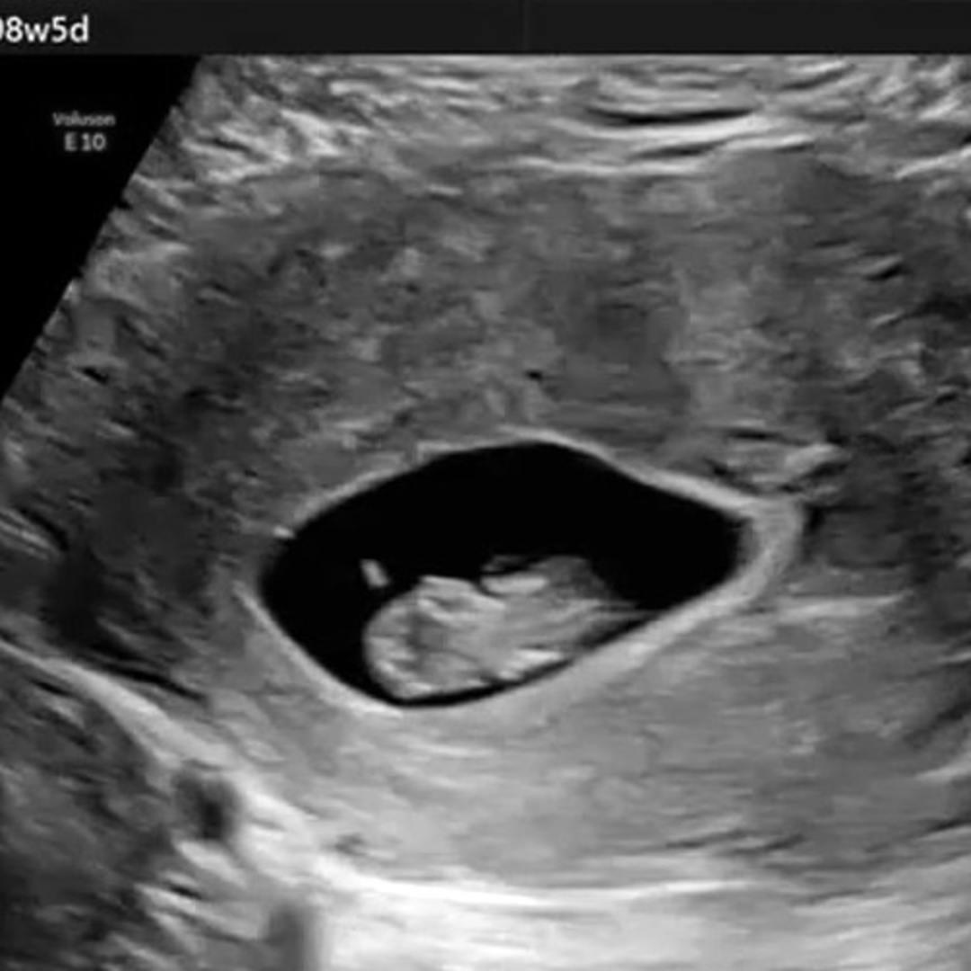 Photo shared by Julia for their Babylist baby registry.