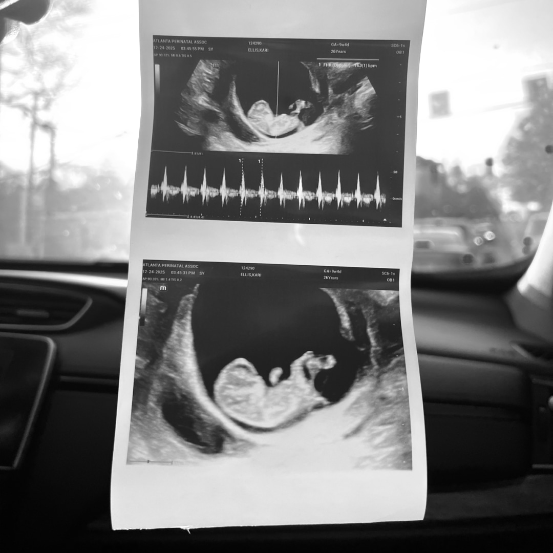 Photo shared by Kari for their Babylist baby registry.