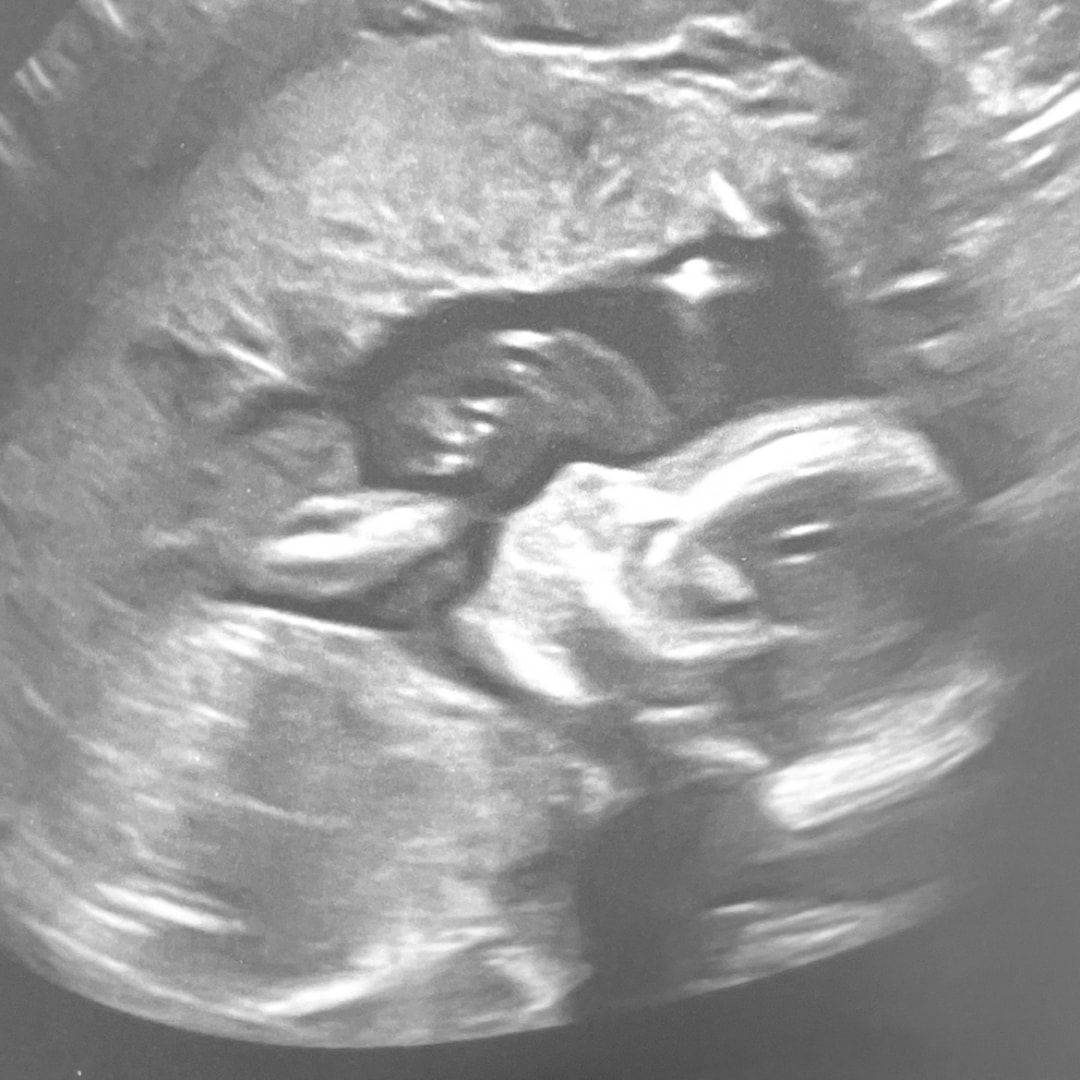 Photo shared by Cassandra for their Babylist baby registry.