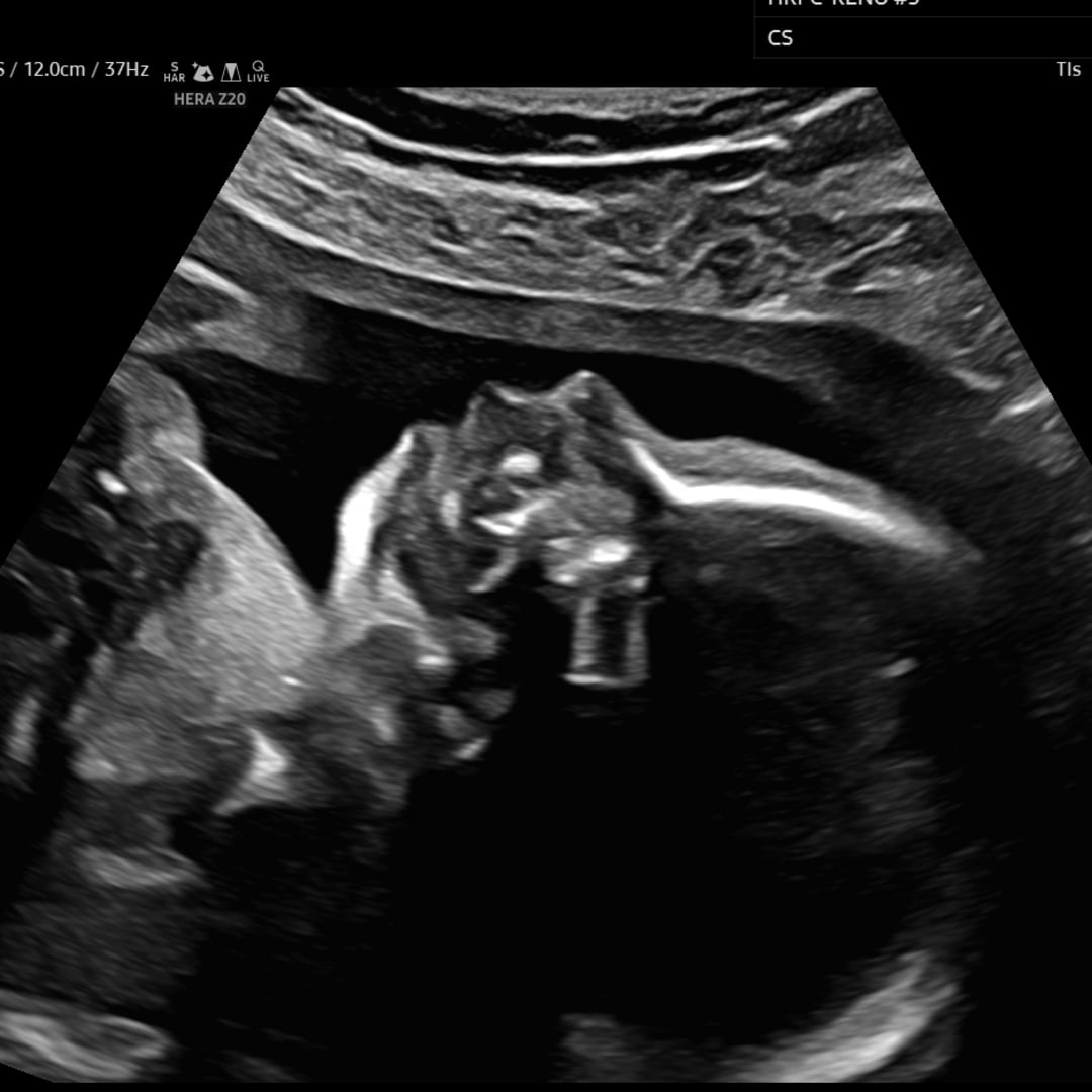 Photo shared by Kindra for their Babylist baby registry.