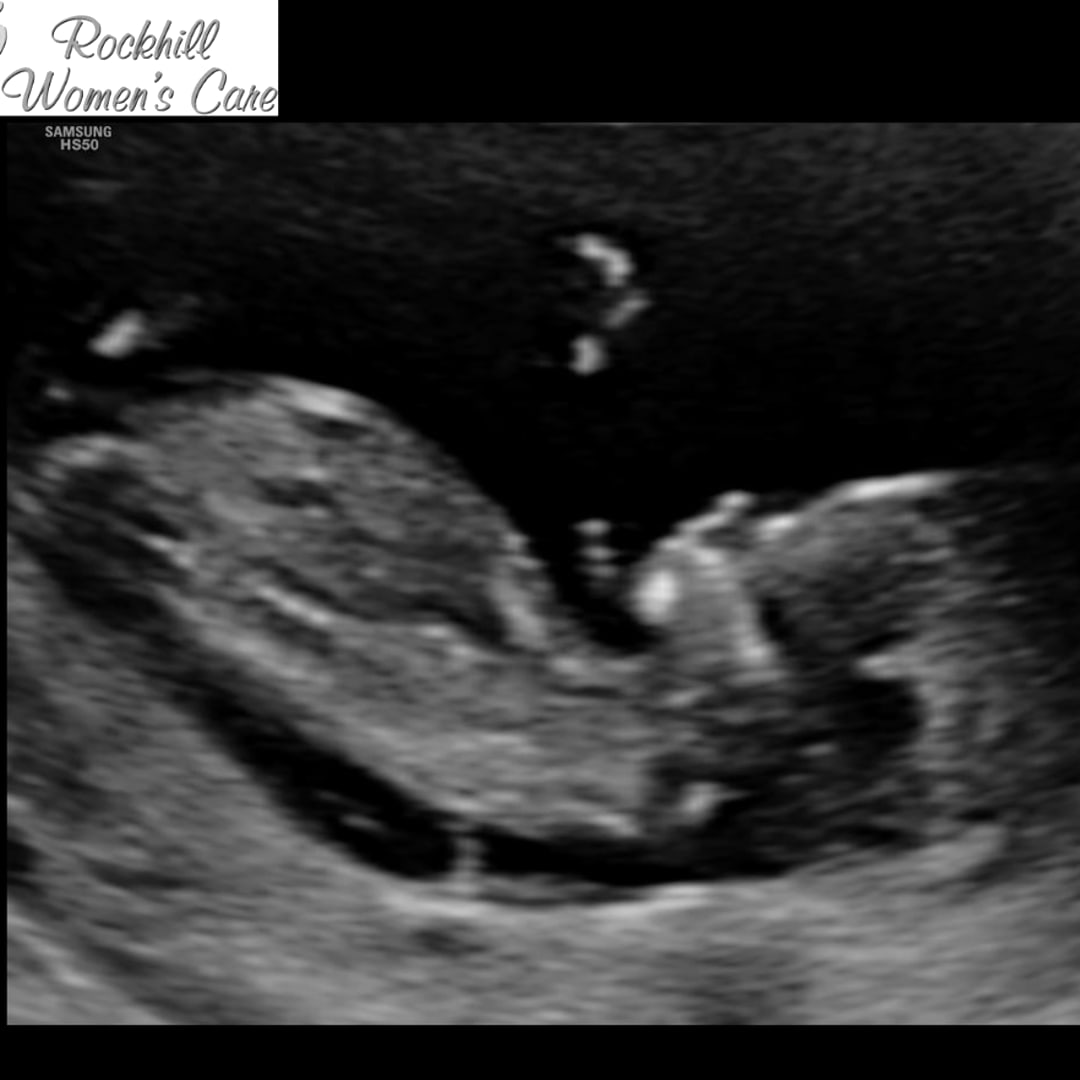 Photo shared by Mikayla for their Babylist baby registry.