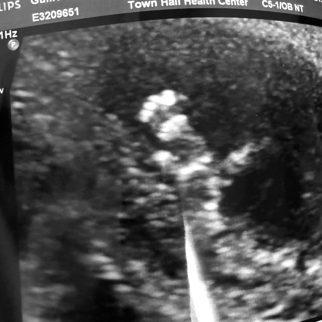 Photo shared by Rebecca for their Babylist baby registry.