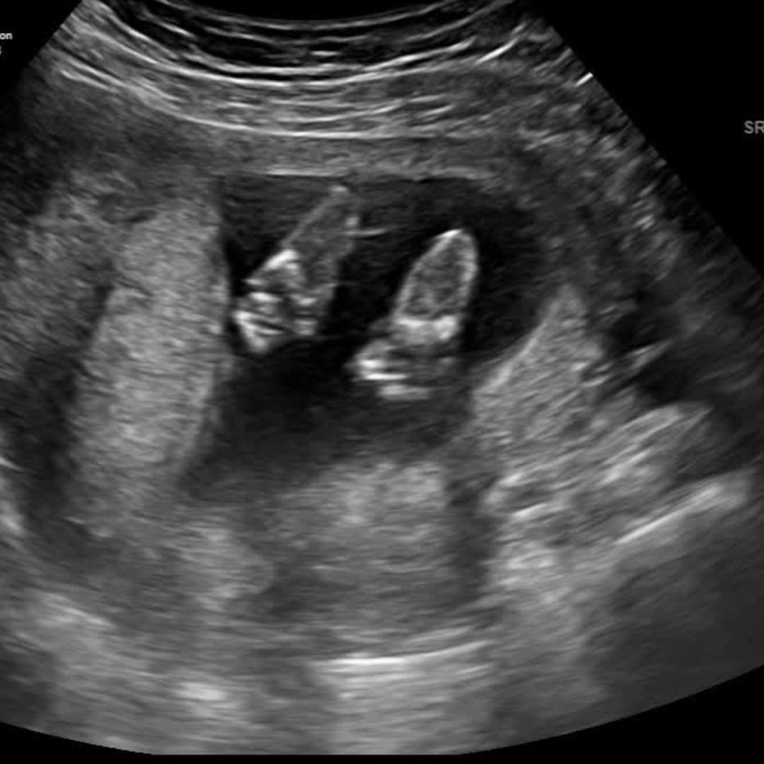 Photo shared by Hannah for their Babylist baby registry.